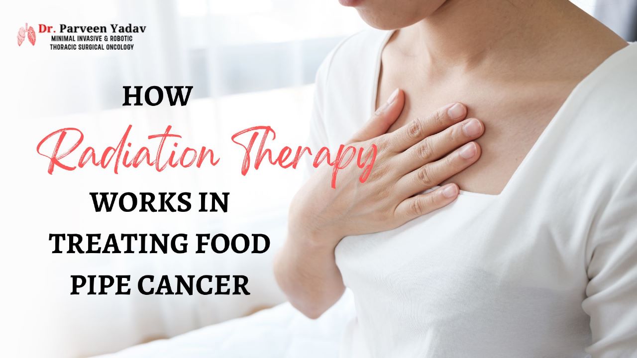 How Radiation Therapy Works In Treating Food Pipe Cancer?