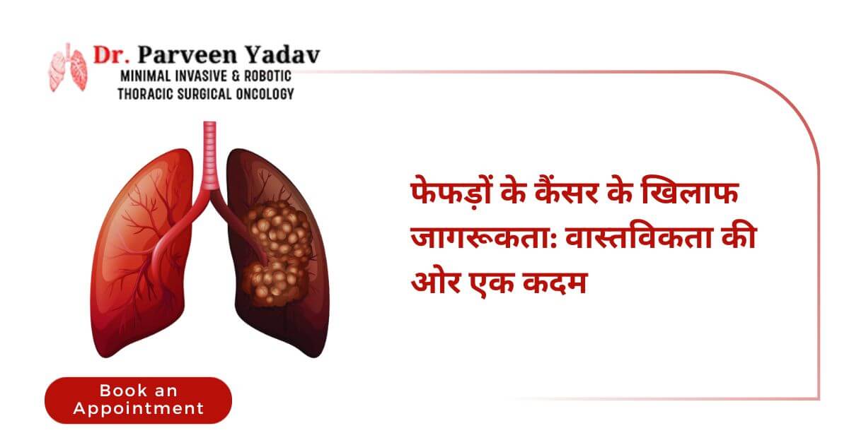 फेफड़ों के कैंसर के खिलाफ जागरूकता: वास्तविकता की ओर एक कदम