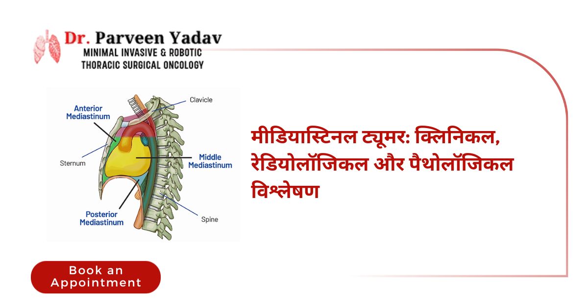 मीडियास्टिनल ट्यूमर: क्लिनिकल, रेडियोलॉजिकल और पैथोलॉजिकल विश्लेषण