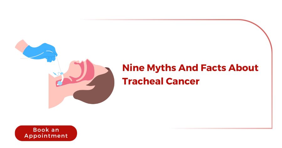 Nine Myths And Facts About Tracheal Cancer