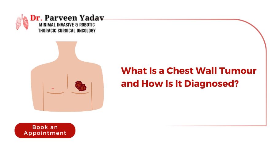 What Is a Chest Wall Tumour and How Is It Diagnosed?