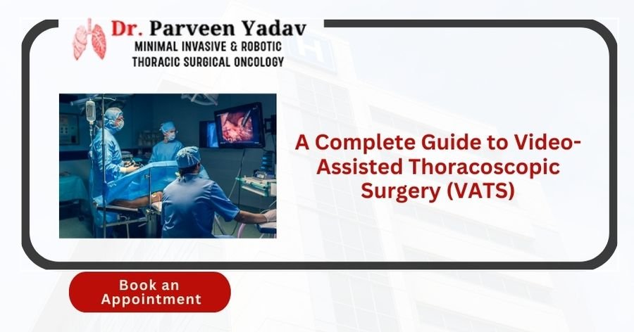 A Complete Guide to Video-Assisted Thoracoscopic Surgery (VATS)